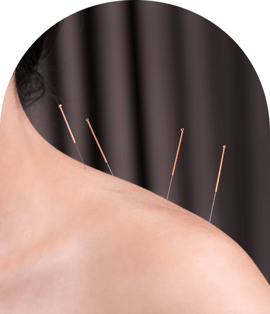Korean Acupunture